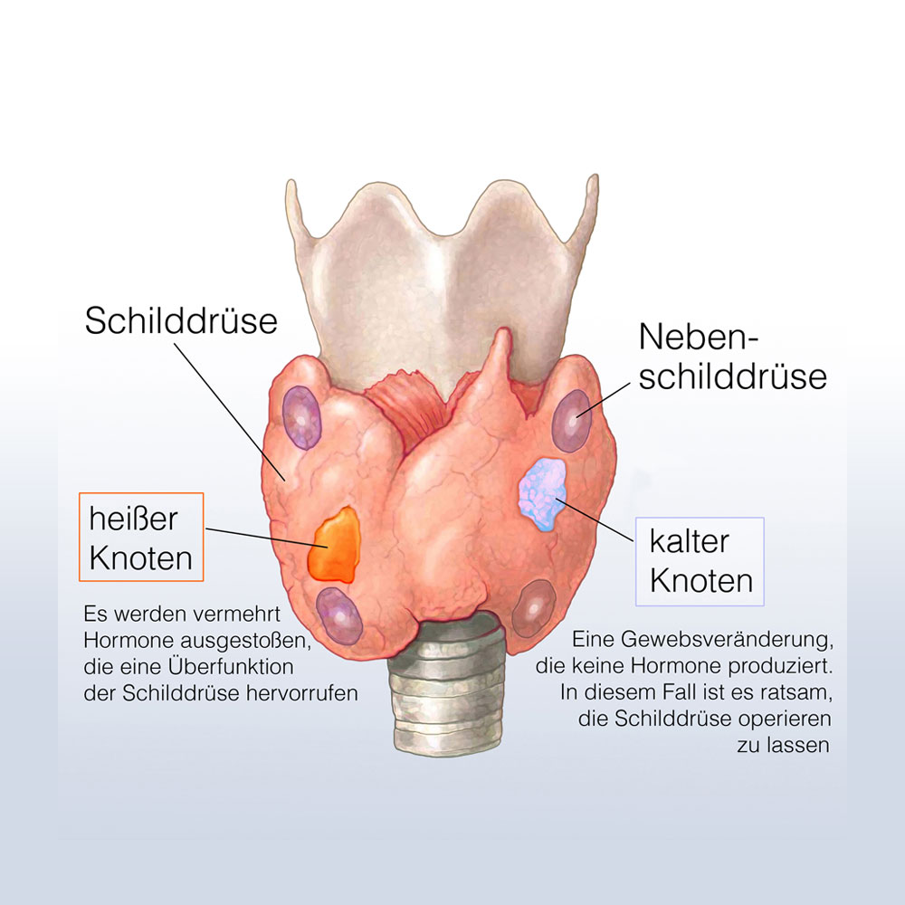 Schilddrüse