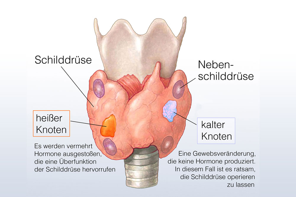 Schilddrüse